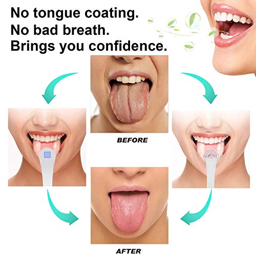 Stainless Steel Professional Tongue Scraper Cleaner for 1 Pcs, Reducing Bad B...