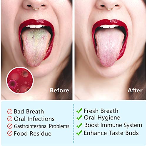 Tongue Scraper,Morgles 4Pcs Tongue Scrapers for Adults Kids Medical Grade Met...