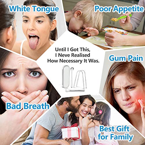 Tongue Scraper,Morgles 4Pcs Tongue Scrapers for Adults Kids Medical Grade Met...