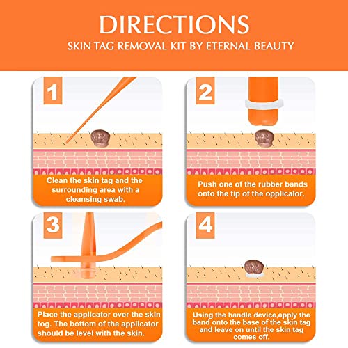 【2 Pack】Skin Tag Remover, Skin Tag Removal Kit Tools with 36Pcs Repair Patc...