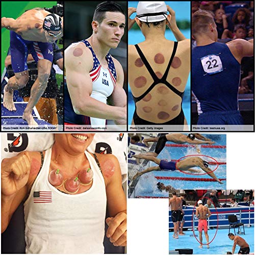 Cupping Set Professional Chinese Acupoint Cupping Therapy Sets, Suction Hijam...