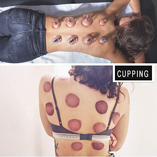 Cupping Set Professional Chinese Acupoint Cupping Therapy Sets, Suction Hijam...