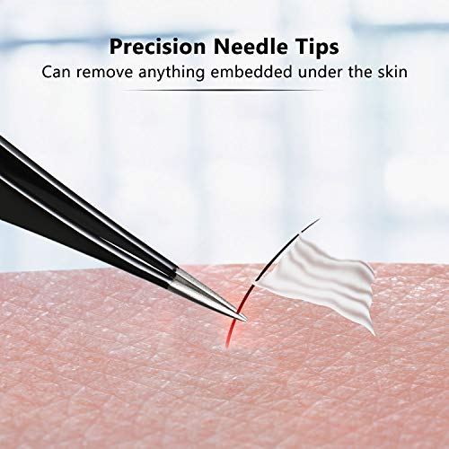 3 Pieces Pointed Tweezers Ingrown Hair Tweezers Precision Needle Nose Pointed...