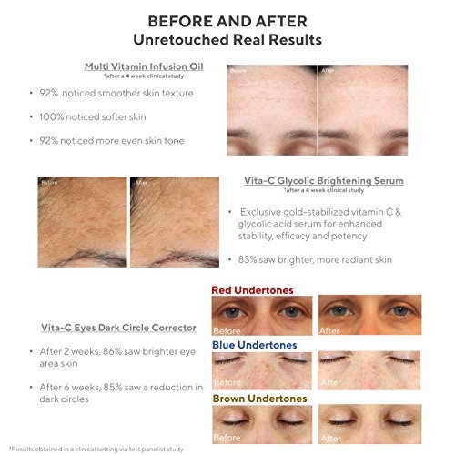 Murad 30 Day Vitamin C Rapid Brightening Kit ($90 Value) with Travel Sizes of...