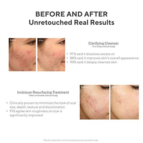 Murad Acne Control Kit – 30-Day Trial Breakout Skin Care Kit with InvisiScar ...