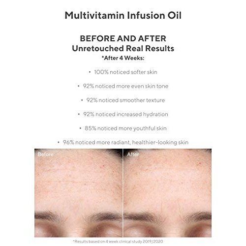 Murad Hydrate Trial Kit - Moisturizing Skincare Set with AHA/BHA Exfoliating ...