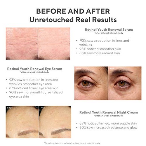 Murad Youth Renewal Retinol Trial Kit – Anti-Aging Retinol Youth Skincare Set...