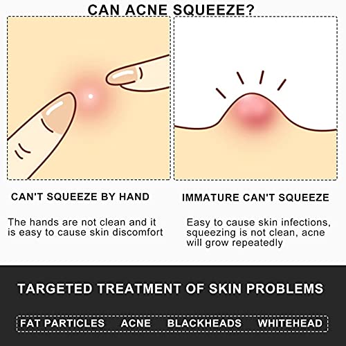 Professional Facial Milia Removal and Whitehead Extractor & Lancet - Double E...