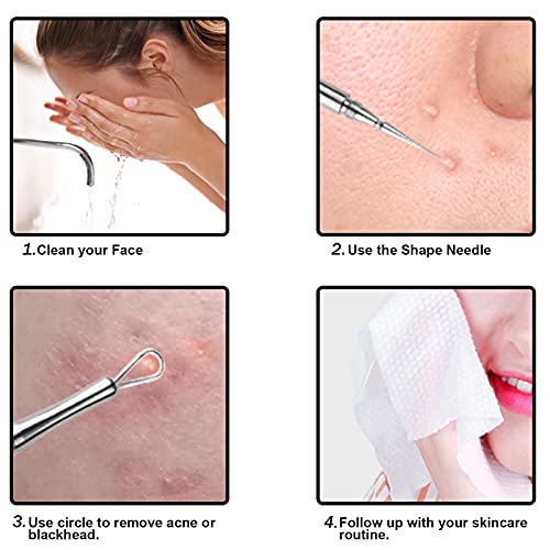 Professional Facial Milia Removal and Whitehead Extractor & Lancet - Double E...