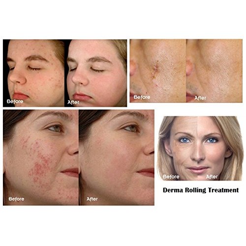 Copper Peptide Serum With Swiss Apple Stem Cell Boosts Collagen Production. I...