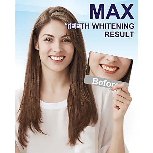 MySmile Teeth Whitening Kit Enhanced Teeth Whitener Flagship Version,10 Min 6...