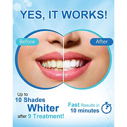 MySmile Teeth Whitening Pen for Sensitive Teeth, Fast Result Teeth Bleach Pen...