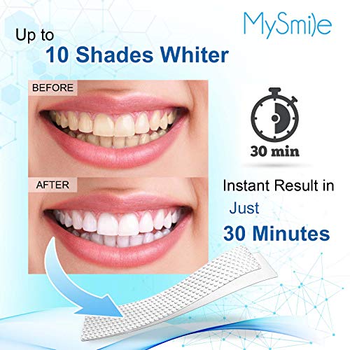 MySmile Teeth Whitening Strips, White Strips Teeth Whitening Kit, Non-Sensiti...