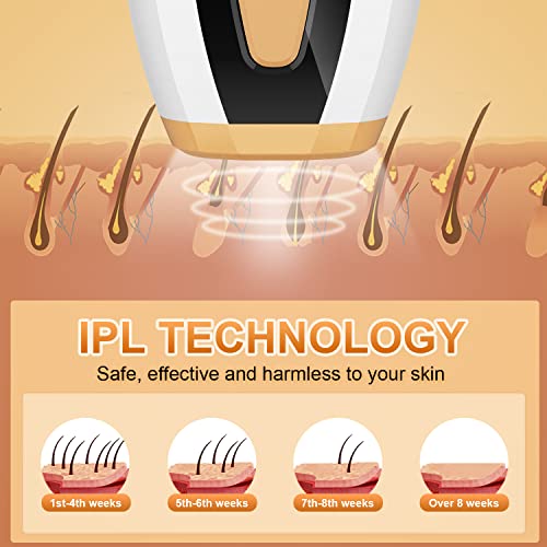 MYWIN IPL Hair Removal Device with 999,999 Flashes Quartz Lamp, IPL Hair Remo...