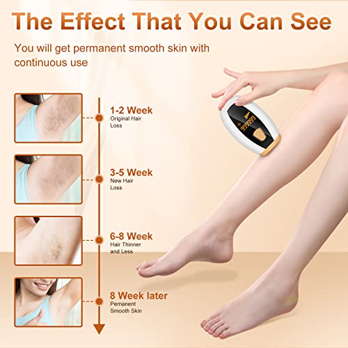 MYWIN IPL Hair Removal Device with 999,999 Flashes Quartz Lamp, IPL Hair Remo...