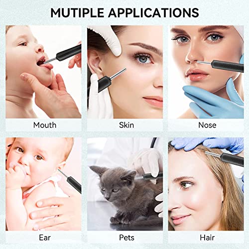 Ear Cleaning - Ear Wax Remover - Metal Handle - Otoscope Thermostat 25°c - Wi...