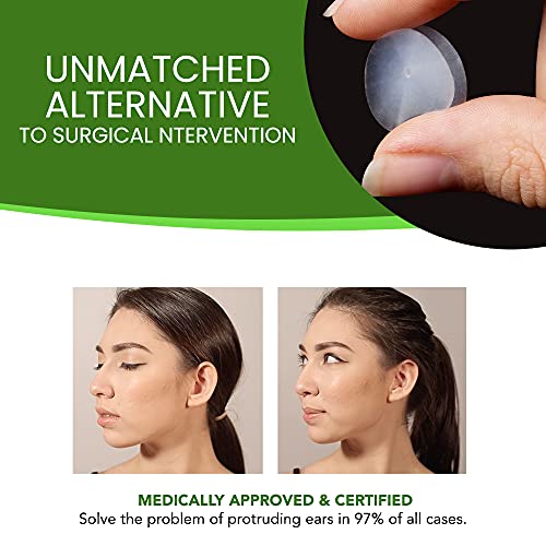 Pretty Ears Cosmetic Ear Correctors (4 Pairs) – Behind Ear Adhesive Ear Corre...