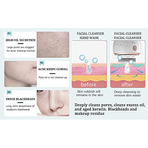 Facial Cleansing Brush Heads,Facial Brush Replacement Heads,for 6 Skin Types(...