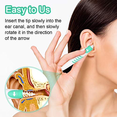 Ear Wax Removal, Soft Ear Wax Remover, NaCot Spiral Silicone Ear Wax Removal ...
