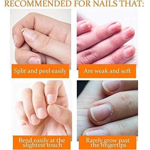 Nail Tek Nail Recovery Kit, Cuticle Oil, Strengthener, Ridge Filler - Restore...