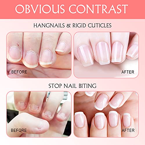 Nailive Nail Cuticle Oil Jojoba Cutical Essence Nails Oils Heals Dry Cracked ...