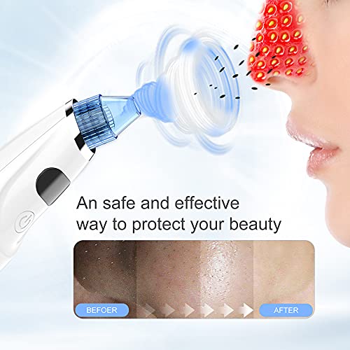 Blackhead Remover Pore Vacuum - Upgraded Electric Pore Cleaner Blackhead Remo...