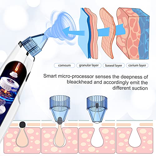 Blackhead Remover Pore Vacuum - Upgraded Electric Pore Cleaner Blackhead Remo...