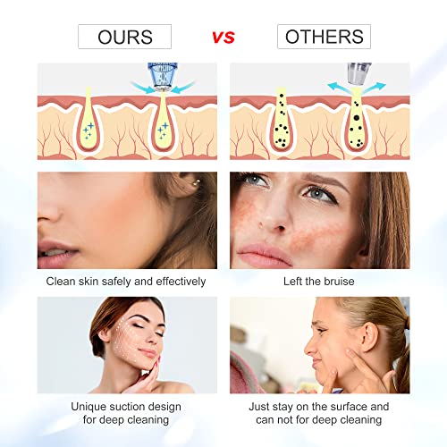 Blackhead Remover Pore Vacuum - Upgraded Electric Pore Cleaner Blackhead Remo...