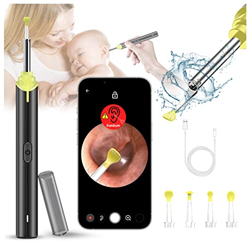 Naradoo Ear Wax Removal with Camera Wireless Ear Wax Cleaning Tool with 1080P...