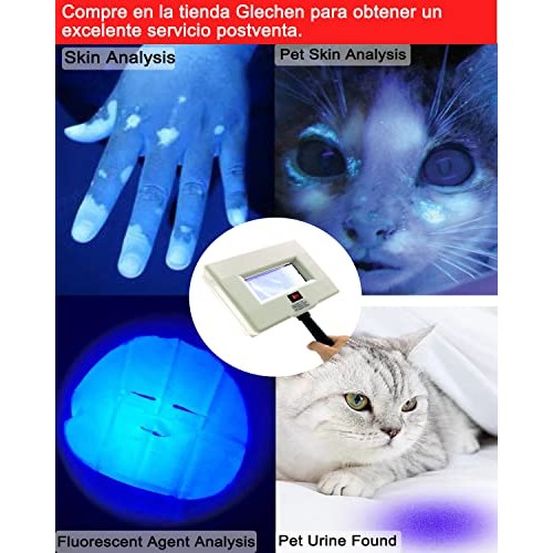 NaSeny Woods Lamp Skin Analyzer Machine Handheld Facial Wood Lamp with Blocki...