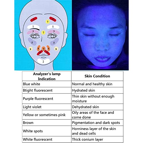 NaSeny Woods Lamp Skin Analyzer Machine Handheld Facial Wood Lamp with Blocki...