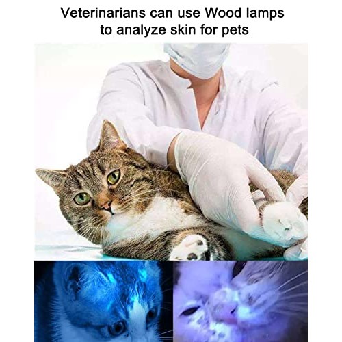 NaSeny Woods Lamp Skin Analyzer Machine Handheld Facial Wood Lamp with Blocki...