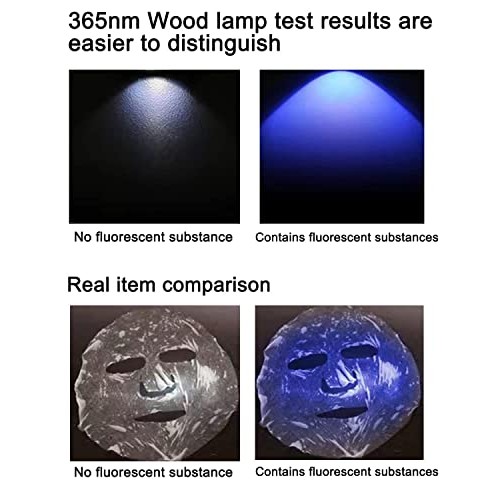NaSeny Woods Lamp Skin Analyzer Machine Handheld Facial Wood Lamp with Blocki...