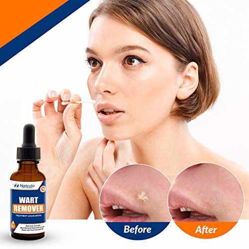 Natural Wart Remover Treatment Liquid Drops – Fast, Safe for Kids, Maximum St...