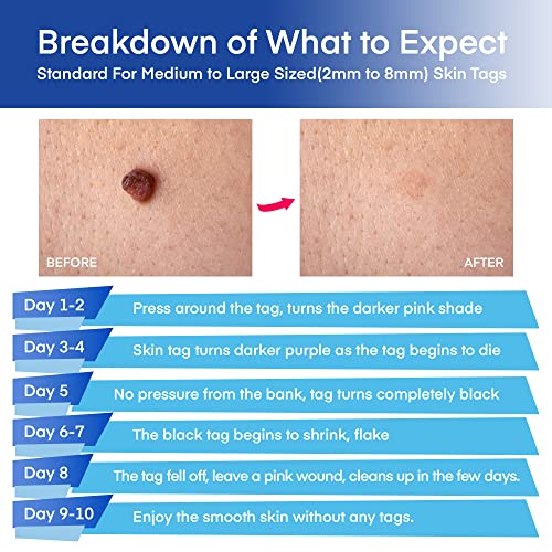Natural Vine Skin Tag Remover Device Kits, for 2-8mm Tags, for All Body Parts...