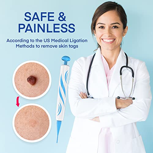 Natural Vine Skin Tag Remover Device Kits, for 2-8mm Tags, for All Body Parts...