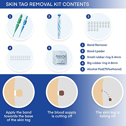 Natural Vine Skin Tag Remover Device Kits, for 2-8mm Tags, for All Body Parts...