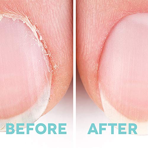 Cuticle Dr - Cuticle Oil for Skin and Nail Conditioning - All Natural Nail Re...