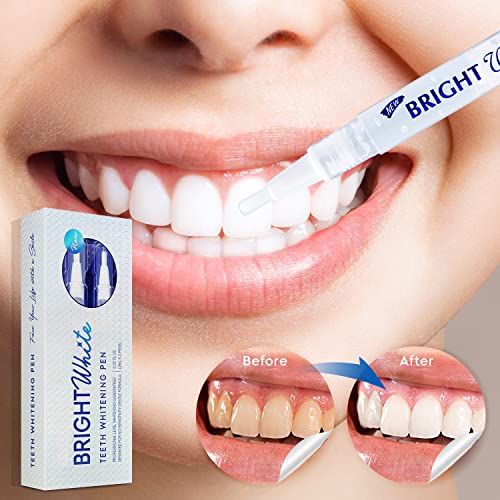 Teeth Whitening Pen (2 Pens), 35% Carbamide Peroxide, Fast Result, Painless a...