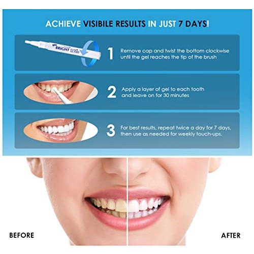 Teeth Whitening Pen (2 Pens), 35% Carbamide Peroxide, Fast Result, Painless a...