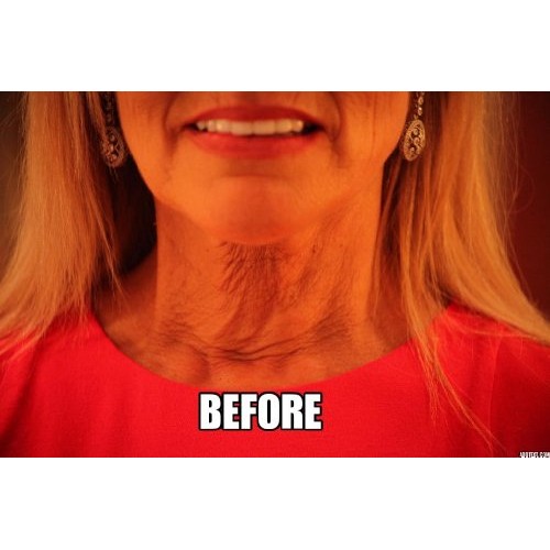 Necktite Magic The Instant Neck Lift