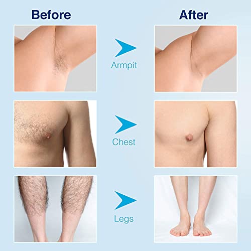 Neomen Hair Removal Cream - Super Gentle & Safe Depilatory Cream - Skin Frien...