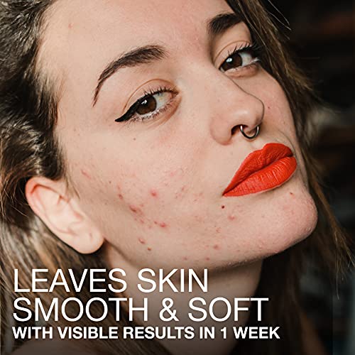 Neutrogena Stubborn Texture Daily Acne Gel Facial Cleanser, Salicylic Acid Ac...