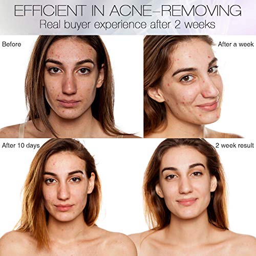 Led Face Mask Light Therapy, NEWKEY 7 Led Light Therapy Facial Skin Care Mask...