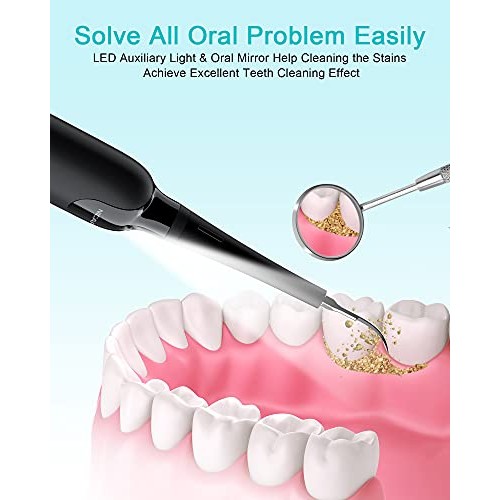 Tooth Cleaning Tools,Teeth Cleaner Tool Kit,Teeth ​Care for Adult,Safe for Ad...