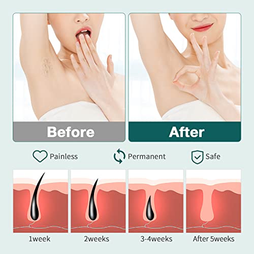 NICEBLE Hair Removal Device with Sapphire Ice-cooling System, Permanent Painl...