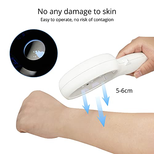 Woods Lamp Skin Analyzer Portable Magnifying Analyzer Beauty Test Facial Care...