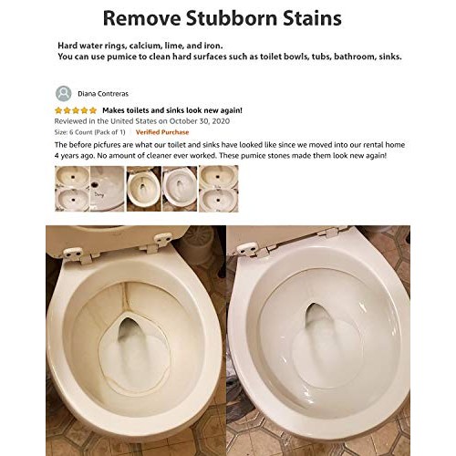 Pumice Stone for Toilet Cleaning Bowl Stick, Refresh Toilet Within 1 Minute, ...