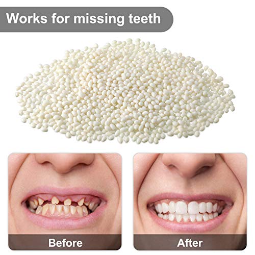 100g Tooth Solid Gel Temporary Repair Kit Moldable Thermal Fitting Bead Teeth...
