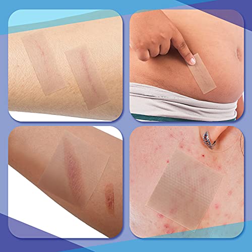 2 Rolls Soft Silicone Tape Easy Tear Gel Tape 1.5 Inch x 1.6 Yard, 1 Inch x 1...